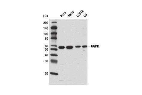m.8k866|G6PD Antibody .